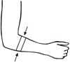 KubiFX Elbow Brace (055300) attēls