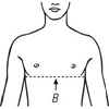 Picture of Clavicle Support (121700)