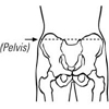 Picture of HerniaFix Elastic Spring Truss with Anatomically-Shaped Pad, Double-Sided (109800) 