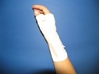 Long wrist orthosis with palm metal strip (C180) attēls