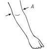 Picture of Elbow Support (1420)